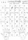 Khmer sign for the deaf (117368 bytes)
